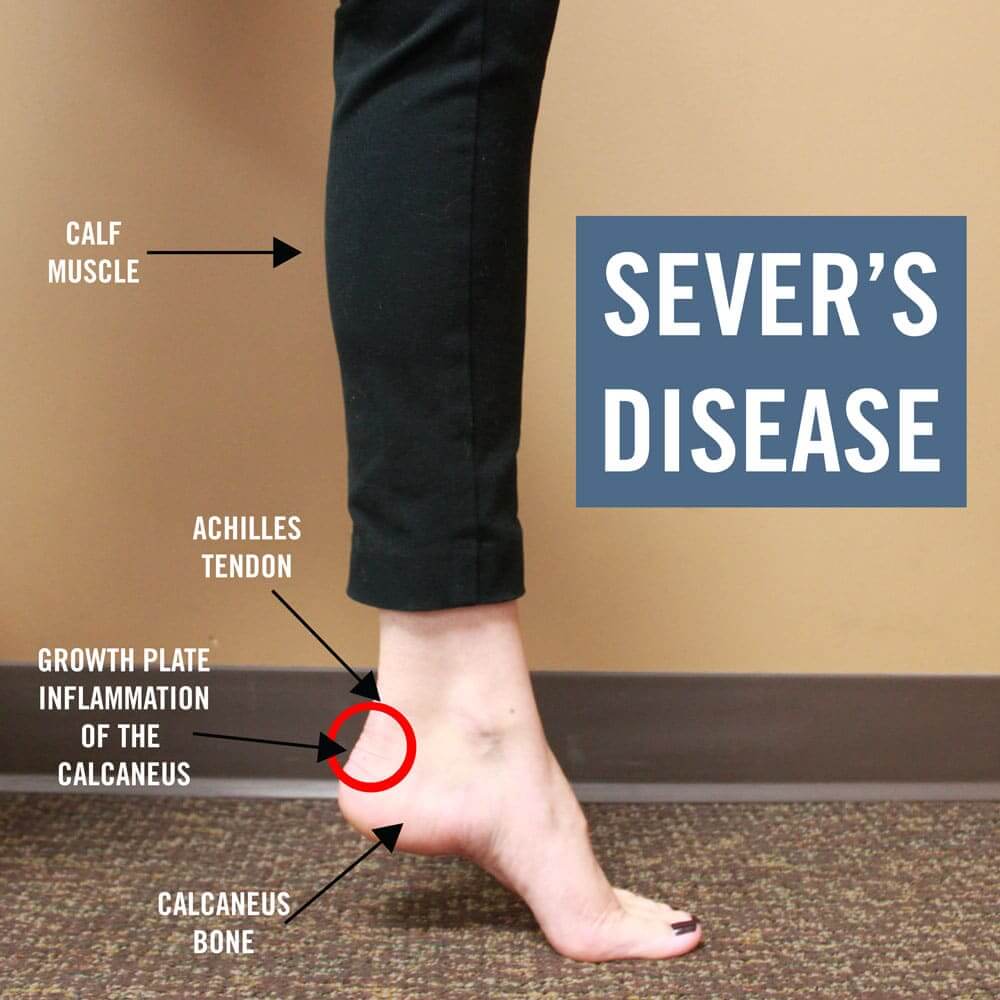Foot pain? Here's 10 common causes... #7 may surprise you - Jamestown  Regional Medical Center